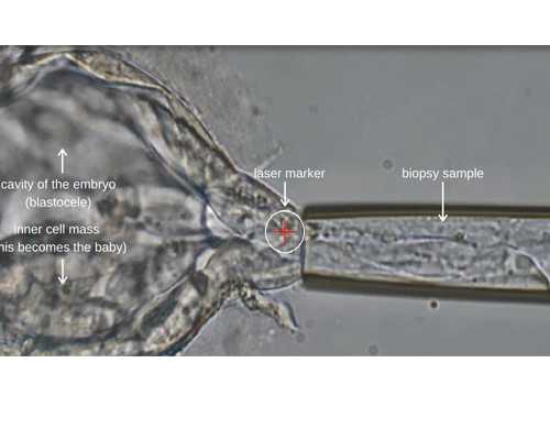 香港验血电子版有医生签字吗_香港验血两次出报告准不准_胎儿性别鉴定会不会