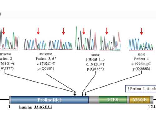 泵扬程怎么选择_颈椎微创手术后注意事项