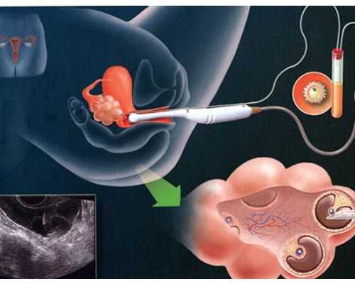 香港验血邮寄血样靠谱吗_去香港验血要几天出结果,DNA鉴定需要哪些条件?