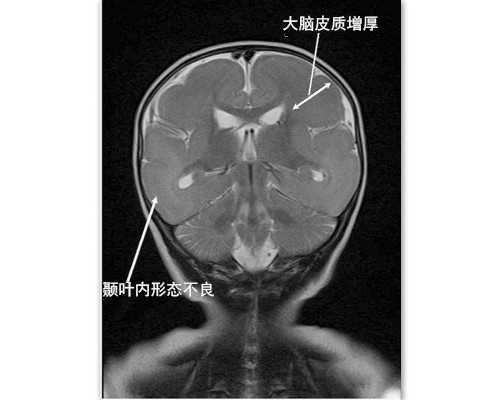 智能潜水泵_泉坛巨擘罗伯昭的家国情怀