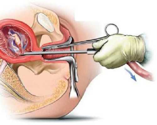 香港戴学良验血诊所_香港公立医院验血查性别吗,抽血验男女有多少翻盘的