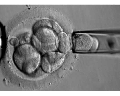 香港验血小众的准吗,备孕出现不孕不育怎么办