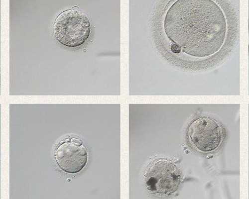 泵领保费是什么意思,梦见楼被水冲是什么意思