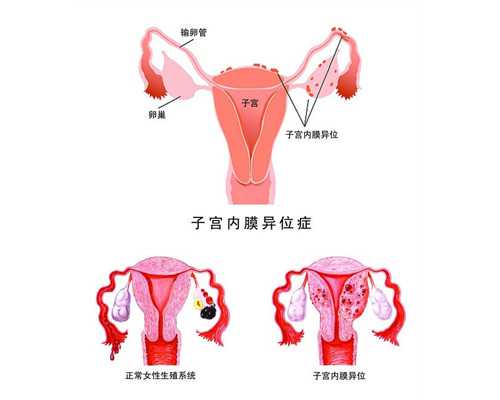 我在香港验血女生了男,到泰国做试管婴儿能决定男女吗