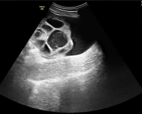 是不是寄血去香港验血都是女孩,“又是一年秋风起”的下一句是什么？《又是