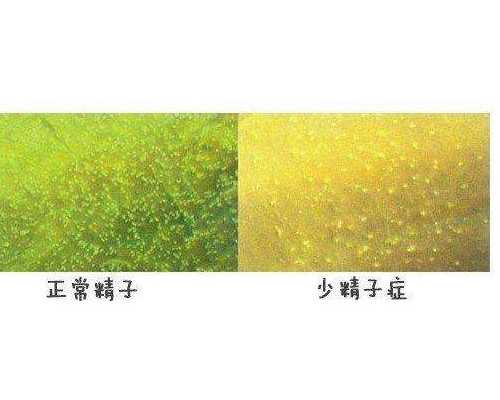 香港6周验血男孩,备孕基础体温怎么看