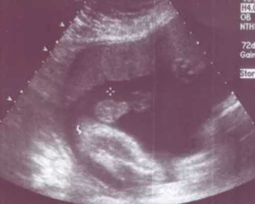 水泵的介绍,男命生儿子的八字极佳子女命