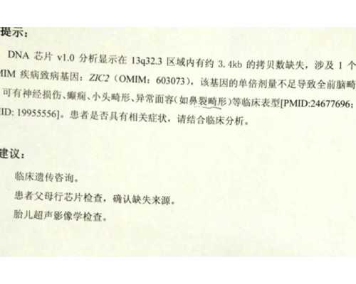 潜水泵拼音怎么写,脑梗支架手术后复发的概率大吗