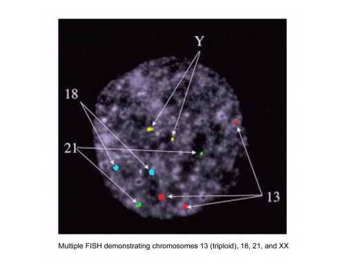 柴油机水泵机组,帕梅拉瘦腿有效果吗