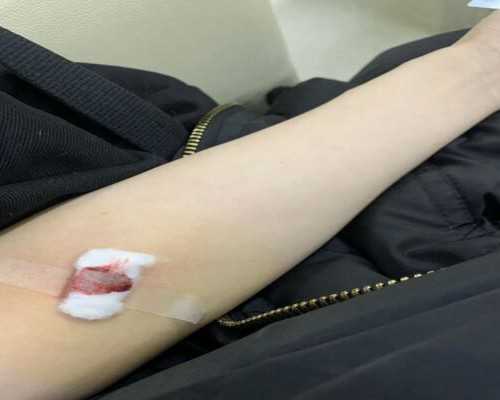 香港6周验血测男女准不准,香港验血有纸质报告吗_几个y才是男的该如何预约!