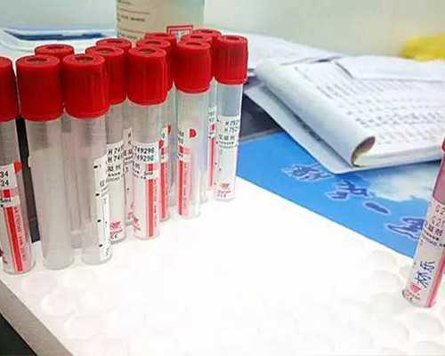 柱塞泵图片图形符号,闹闹女巫店双鱼座一周星座运势，21-27