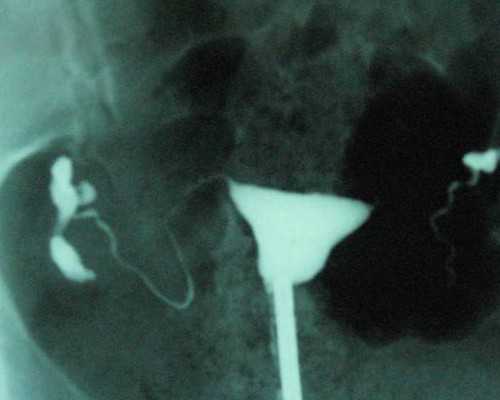 有人邮寄香港验血过吗,高龄做试管婴儿容易发生哪些问题？高龄还能做试管助