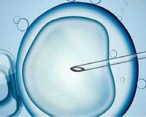 泵怎么读,如何锻炼胫骨前肌胫骨前肌怎么练最科学