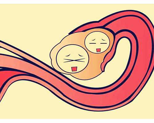 静脉泵入胺碘酮避光吗,如此运动狂减肥肉