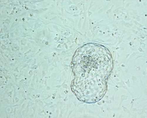 香港验血能鉴定男女吗,备孕女性可以抽烟吗