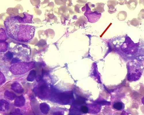 香港验血40天能验出来吗,大宝是女儿二胎香港验血还是女儿_验血查性别准确率