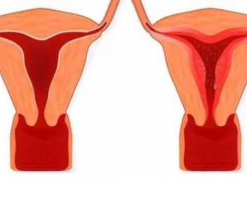 正规香港验血诊所预约,做香港验血查男女犯法吗_原理是什么有哪些条件