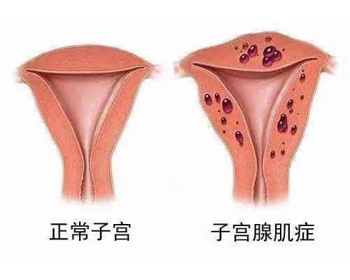 香港验血检测男女结果不一样,输卵管堵塞，做手术好还是试管婴儿好？