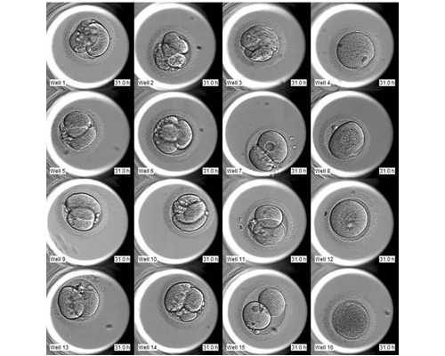 香港多少天验血查男女,高龄女性想备孕生男孩吃什么碱性食物好?