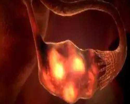 香港验血六周多可以验吗,20年后的我，作 20年后的我，作文20年后的我作文20年