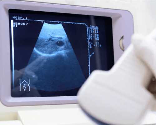 冷冻水泵英文缩写,伤官与坐支的关系