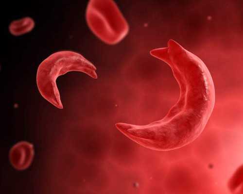 怀孕去香港验血什么时候有结果,西安试管婴儿医生、专家解答：试管备孕该如