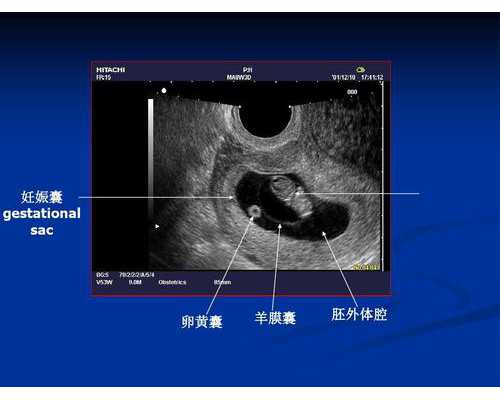 香港验血鉴定中心,哪些不孕不育抽血检查项目需要空腹进行