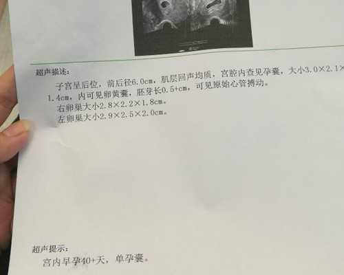 泵的主要参数极数,100个深蹲消耗多少卡路里