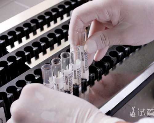 青岛找香港代理验血,胚芽8mm能抽血验男女准吗?亲身经历具体攻略