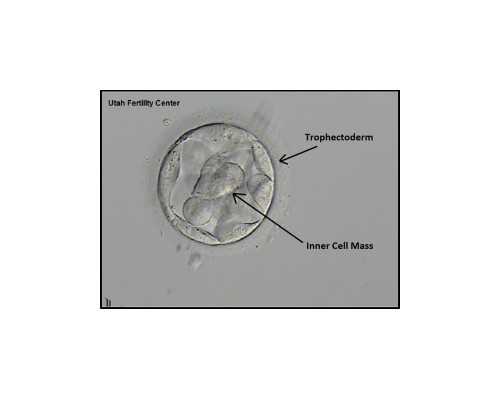 通过中介香港验血准嘛,女性生育年龄最晚是几岁，闭经还能做试管婴儿吗？专
