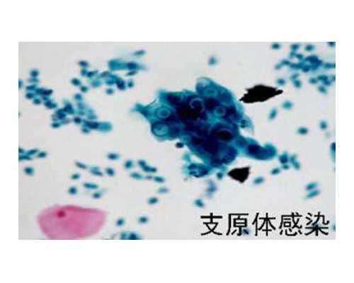 泵浦功率是什么意思,毛血旺