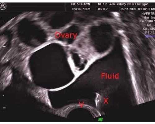 香港验血女孩 准吗,备孕前检查项目
