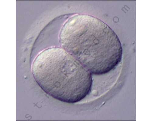 香港8周验血还有可能出错吗,人工授精后吃什么有助于助孕下面几种食物对于怀