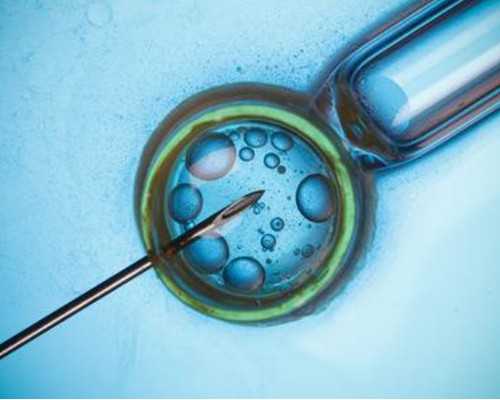 香港胎儿验血性别鉴定 果壳,深圳到香港验血测男女准不准_性别鉴定会不会翻盘