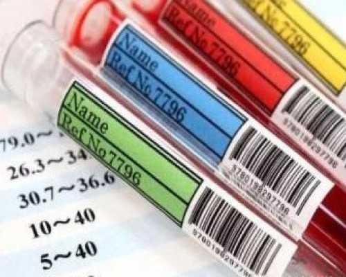 循环水真空泵英文,健身后非经期出血