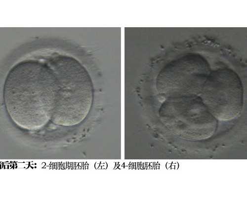 香港正规医院可以验血,备孕喝鲜奶还是牛奶好