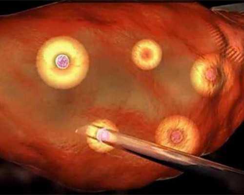 有那个宝妈知道代妈市那家医院做试管婴儿做的好点，