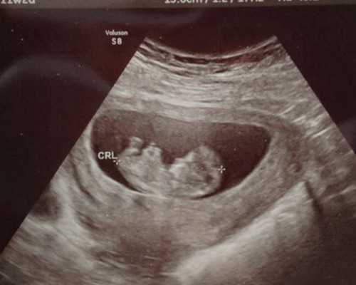 香港验血结果可以在网上查询吗,去香港验血宝宝要多大_验血查性别真的靠谱吗