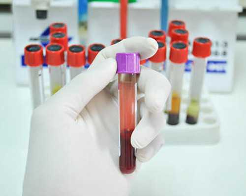 香港验血周五抽血,过香港抽血验胎儿性别准确率高吗?最迟几个月?