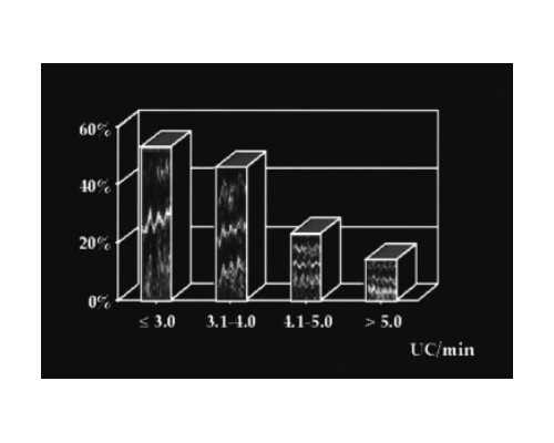 fjx强制循环泵,梦见心上人