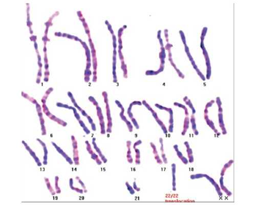 污泥搅拌泵,健走减肥让你不知觉瘦下来