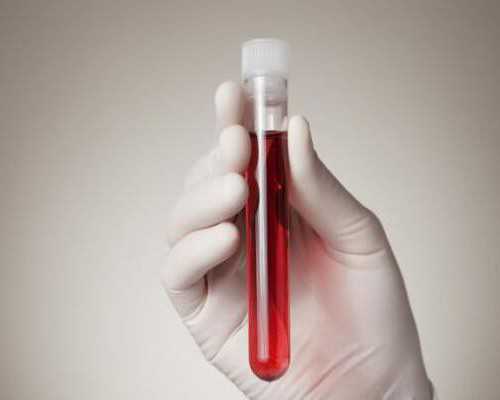 香港寄血验血怎么造假,试管婴儿人工周期解冻移植流程有哪些条件?