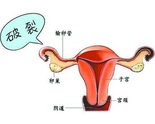 香港验血男女要多久可以验,俄罗斯做三代试管可以选男女吗?靠谱吗?