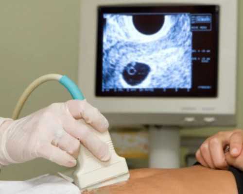 一体化预制泵站设备,远离易长出小肚腩的饮食