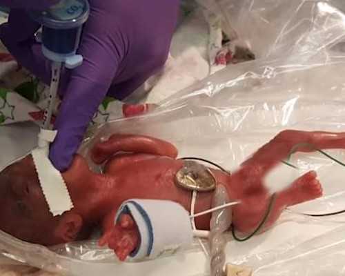 香港两次验血结果不一样,香港验血未满七周抽血_性别鉴定需要注意什么条件