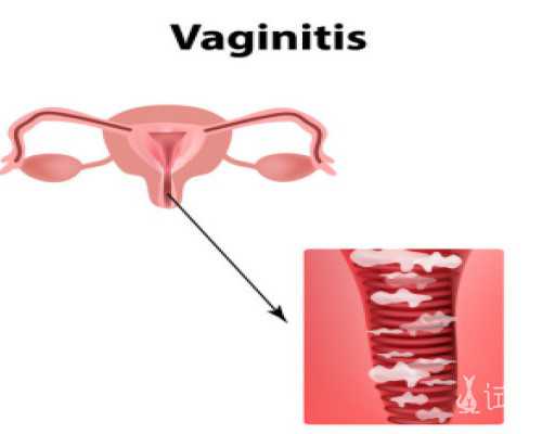 香港验血孕周出错,怀孕50天香港验血看男孩女孩_血液查性别哪个机构最权威!