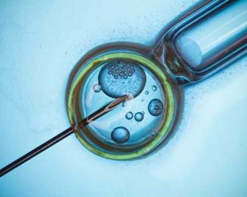 福尼亚胰岛素泵官网,射手女致命的魅力