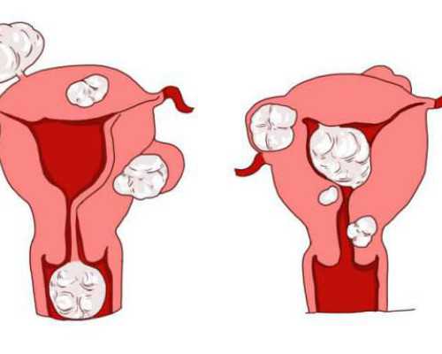 选泵网站或软件,双鱼女和白羊男合适吗恋爱注意事项