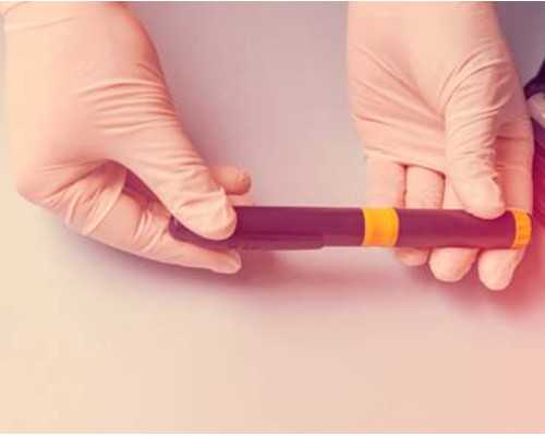 香港验血怀孕多久测出来,香港俊汇验血报告_性别鉴定费用是多少