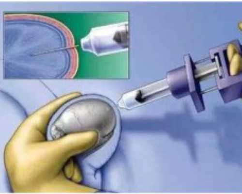 怎样香港验血鉴定男女准吗,流产多久才可以去香港验血_亲身经历告诉你